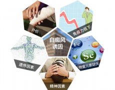 女性白癜风的发病前兆主